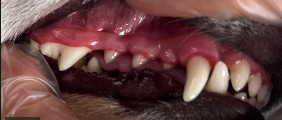 After — clean teeth and healthy gums in a single awake visit, no anesthesia